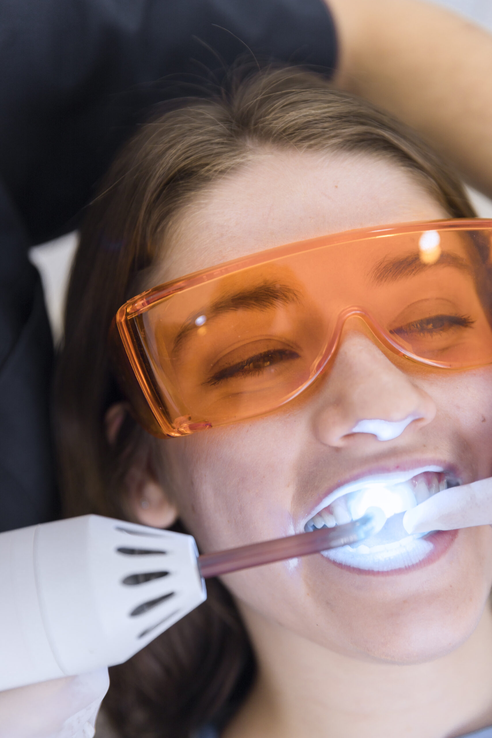 estetica-dental